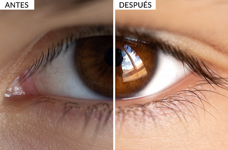 Fotografía Macro Ojo - Editado antes y después